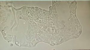 ROS1-cell-line-under-microscope-300x166
